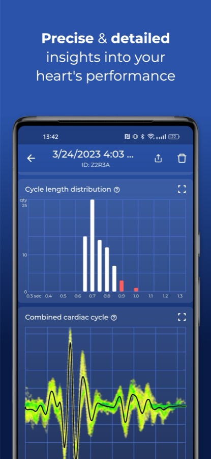 HeartScan screen showing cycle length distribution and the combined cardiac cycle