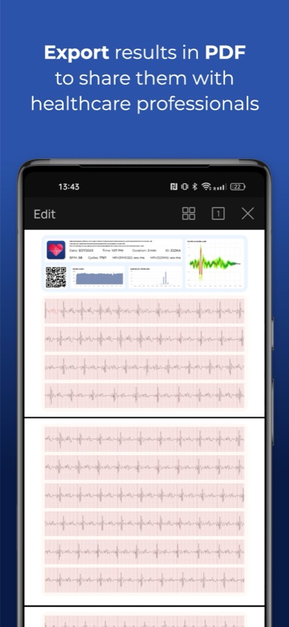 HeartScan recording exported as a PDF report with cardiac cycle charts