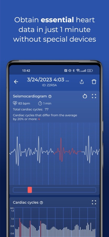 HeartScan seismocardiogram screen showing heart rate, cardiac cycle count and the recorded signal